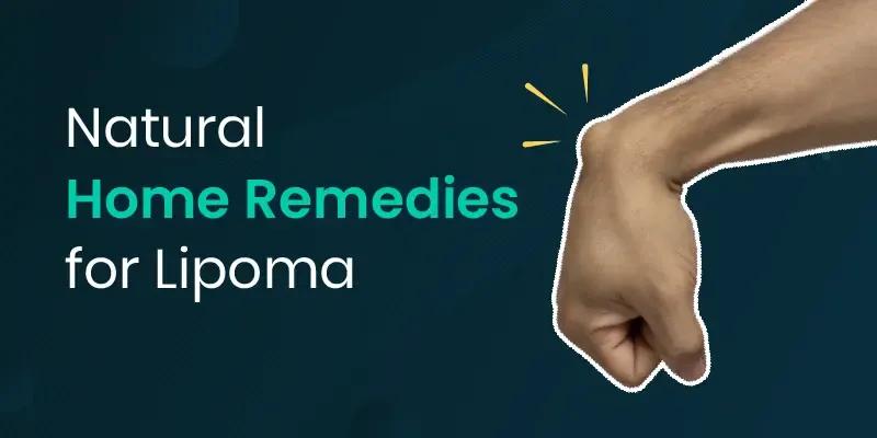 home remedy for lipoma
