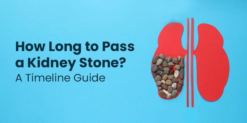 How Long To Pass A Kidney Stone