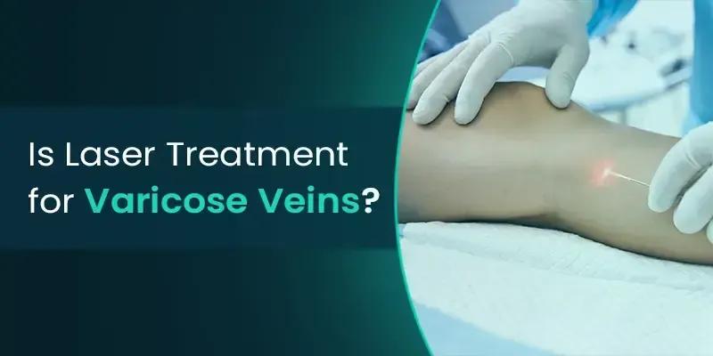 Laser Treatment Effective for Varicose Veins