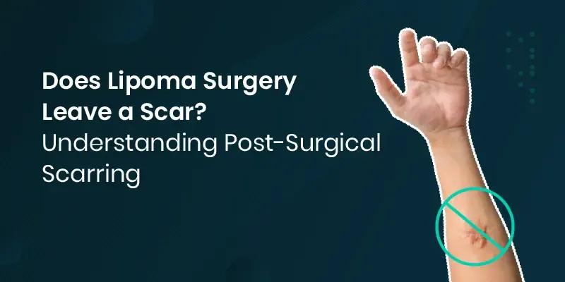 lipoma post surgery scar