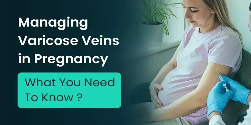 Varicose Veins during Pregnancy