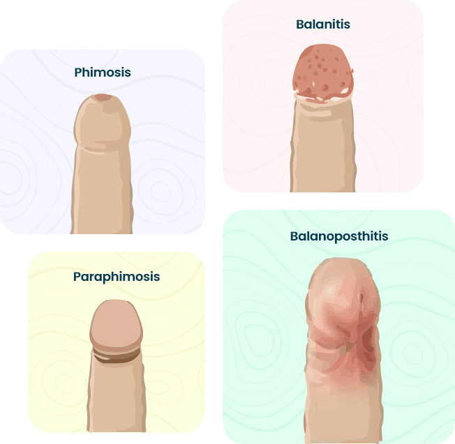 treatment-types-image