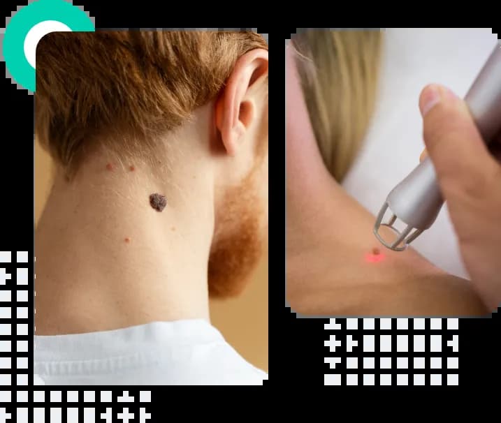 treatment-types-image