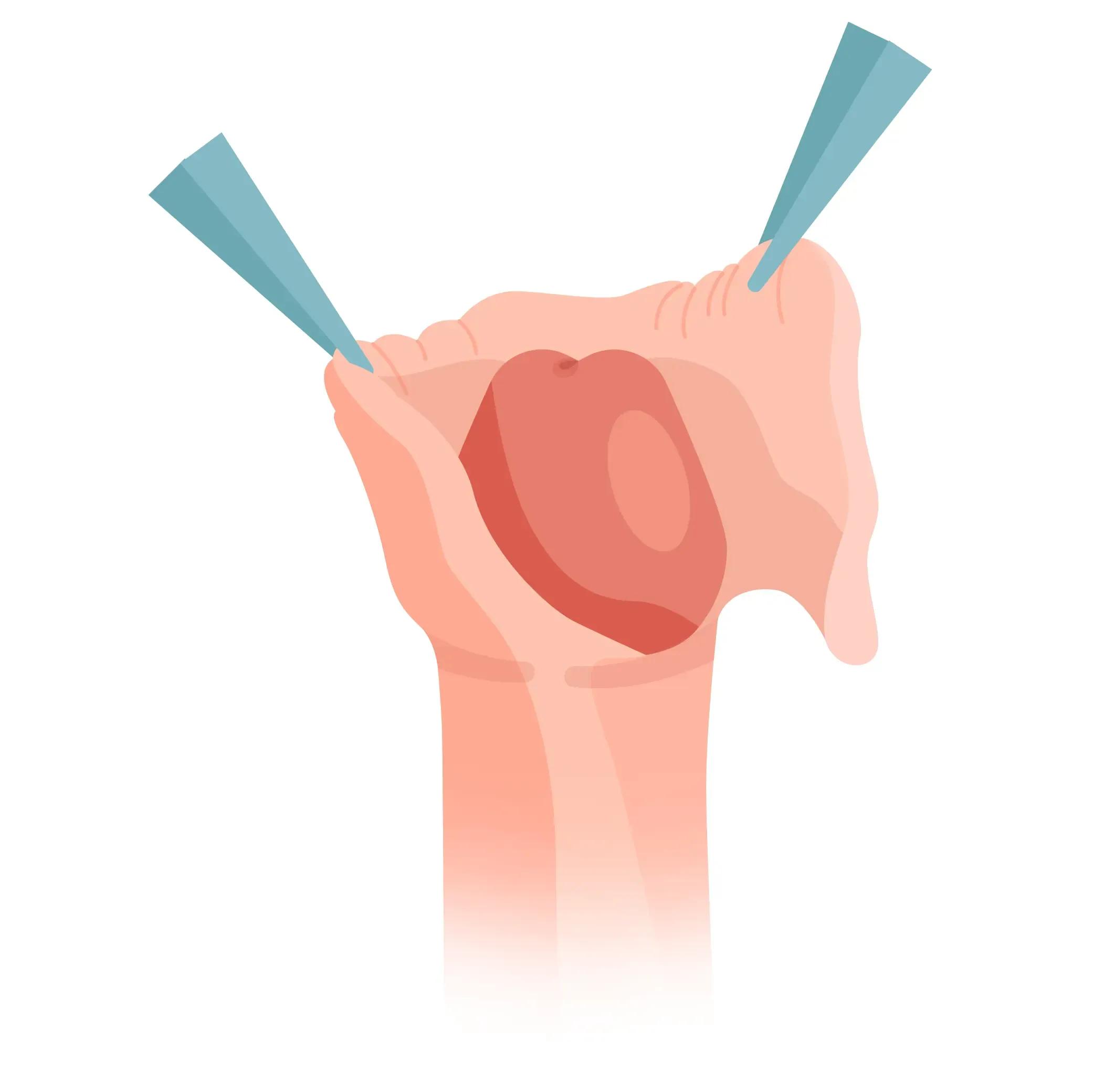 treatment image