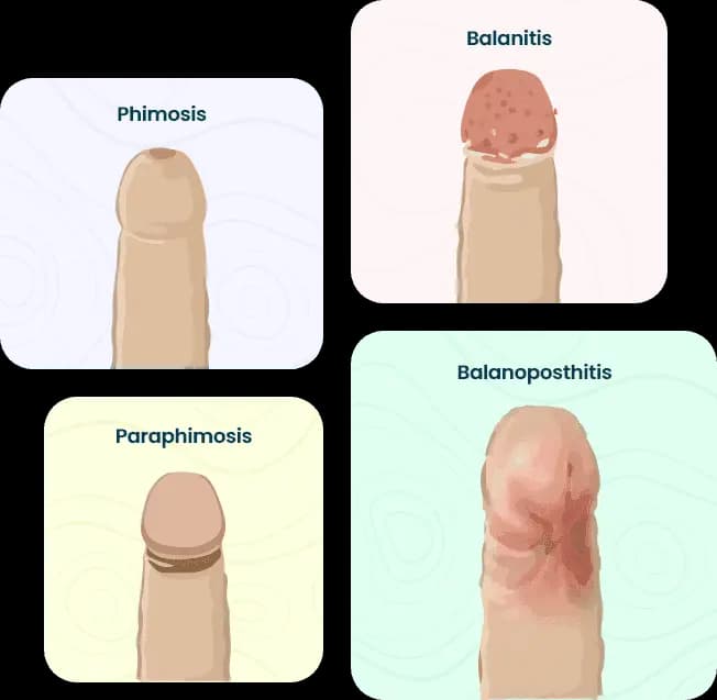 treatment-types-image