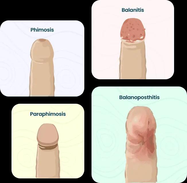 treatment-types-image