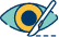 Cataract surgery Cause 5