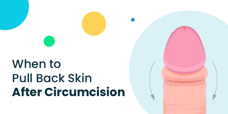 When To Pull Back Skin After Circumcision