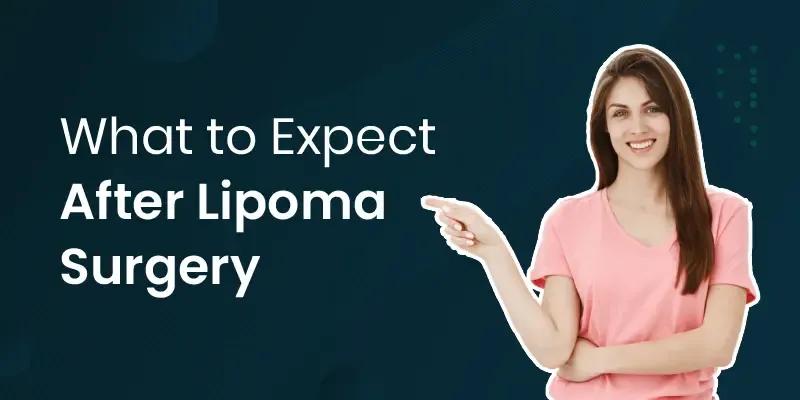 What to Expect After Lipoma Surgery