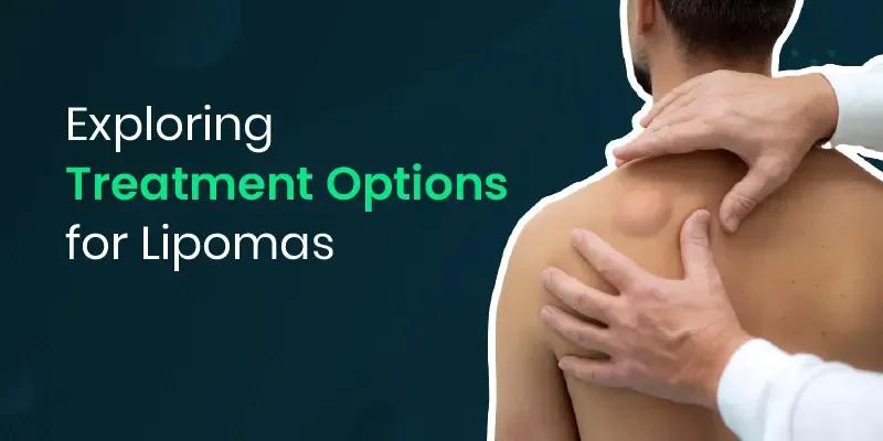 Treatment Options For Lipoma