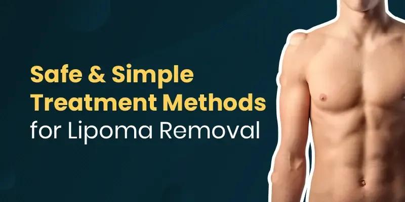  Safe and Simple Treatment Methods for Lipoma Removal