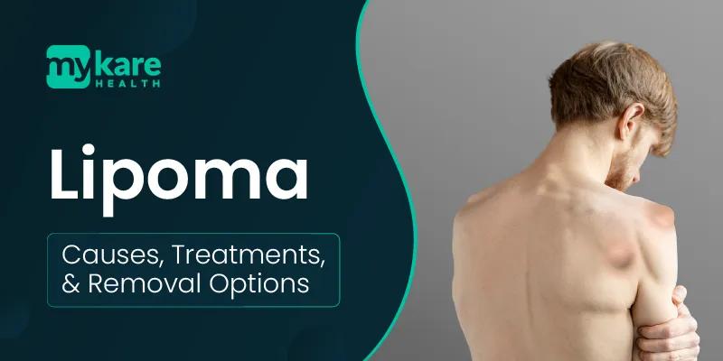 Various lipoma removal methods