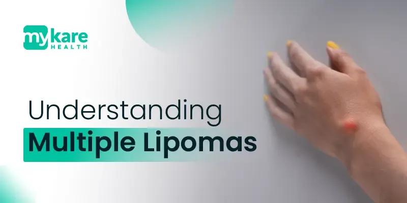 Features of lipomas