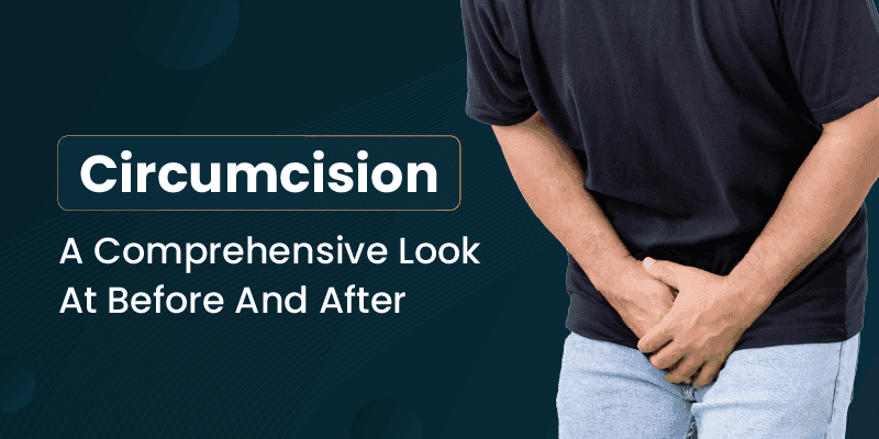 Circumcision Comprehensive Look