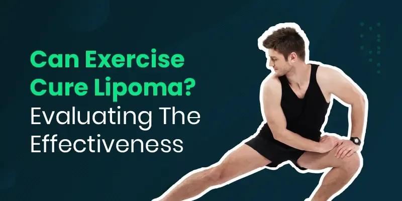 Exercise Cure Lipoma