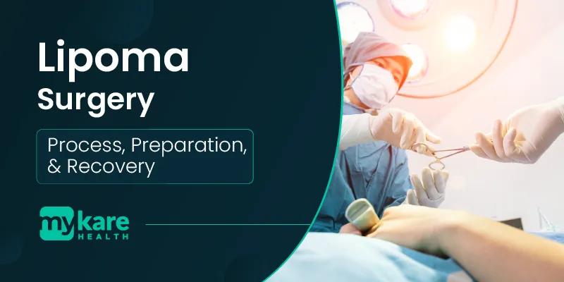 Lipoma surgery in chennai