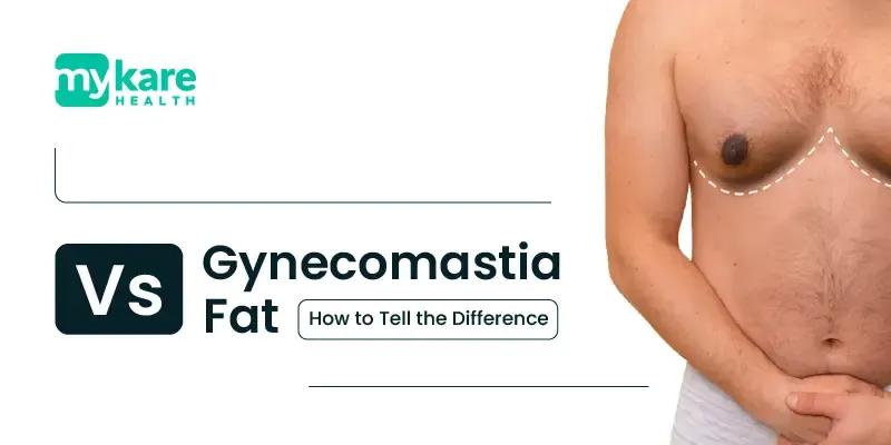 Causes of gynecomastia 