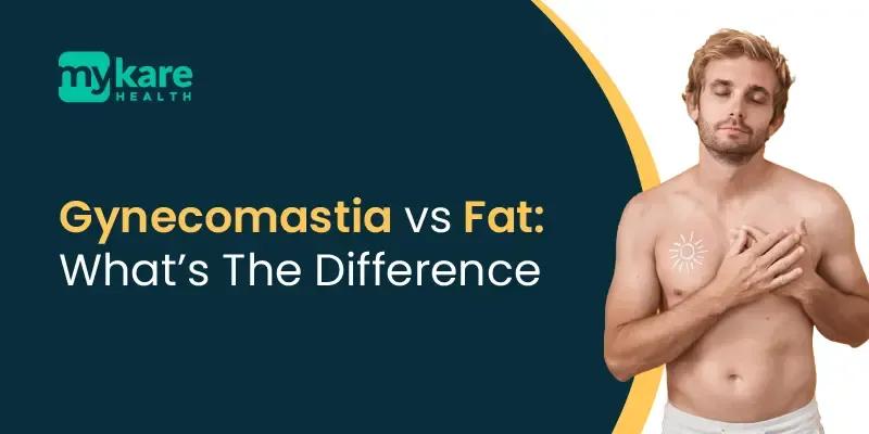 gynecomastia vs fat