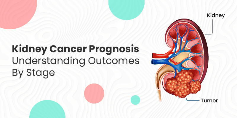 Kidney Cancer Prognosis: Understanding Outcomes by Stage