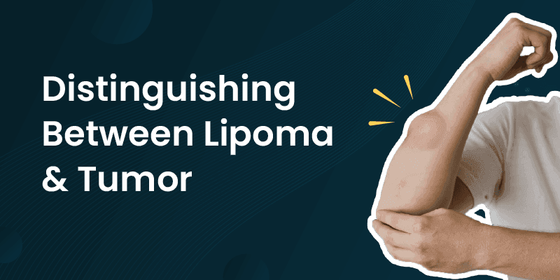 difference between Lipoma And Tumour