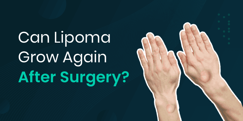 lipoma growing again after surgery