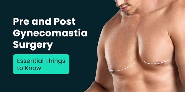 Pre And Post Gynecomastia Surgery Essential Things To Know 8080