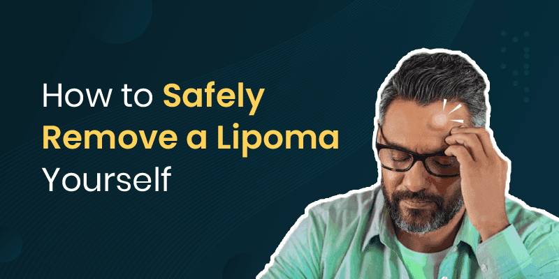 risks of removing lipoma yourself