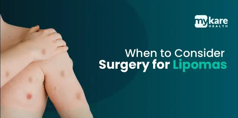 surgery for lipomas