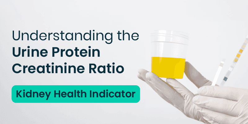 Urine Protein Creatinine Ratio