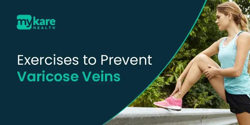 exercise for varicose vein