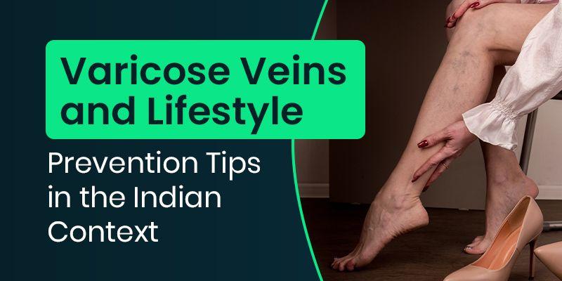 6 ways to avoid varicose veins from pregnancy. Yes, they do