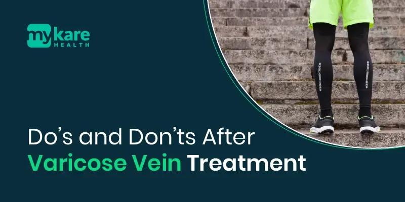 varicose vein treatment 