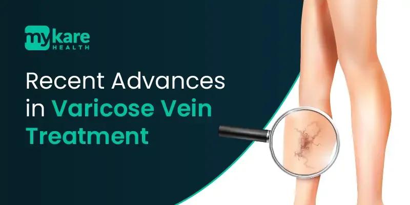 what is varicose vein treatment