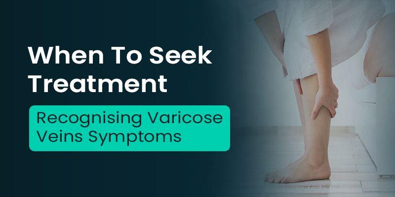 When to Seek Treatment: Recognizing Varicose Veins Symptoms