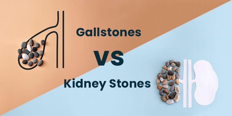 Gallstones vs Kidney Stones: Differences 